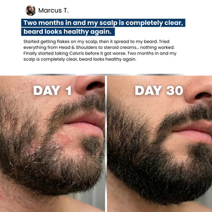 Calvris FlakeFree Capsules™ Calvris