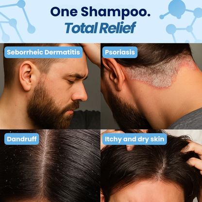 Seborrheic Dermatitis & Psoriasis Shampoo™
