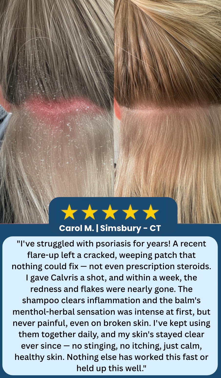 Calvris customer review 2