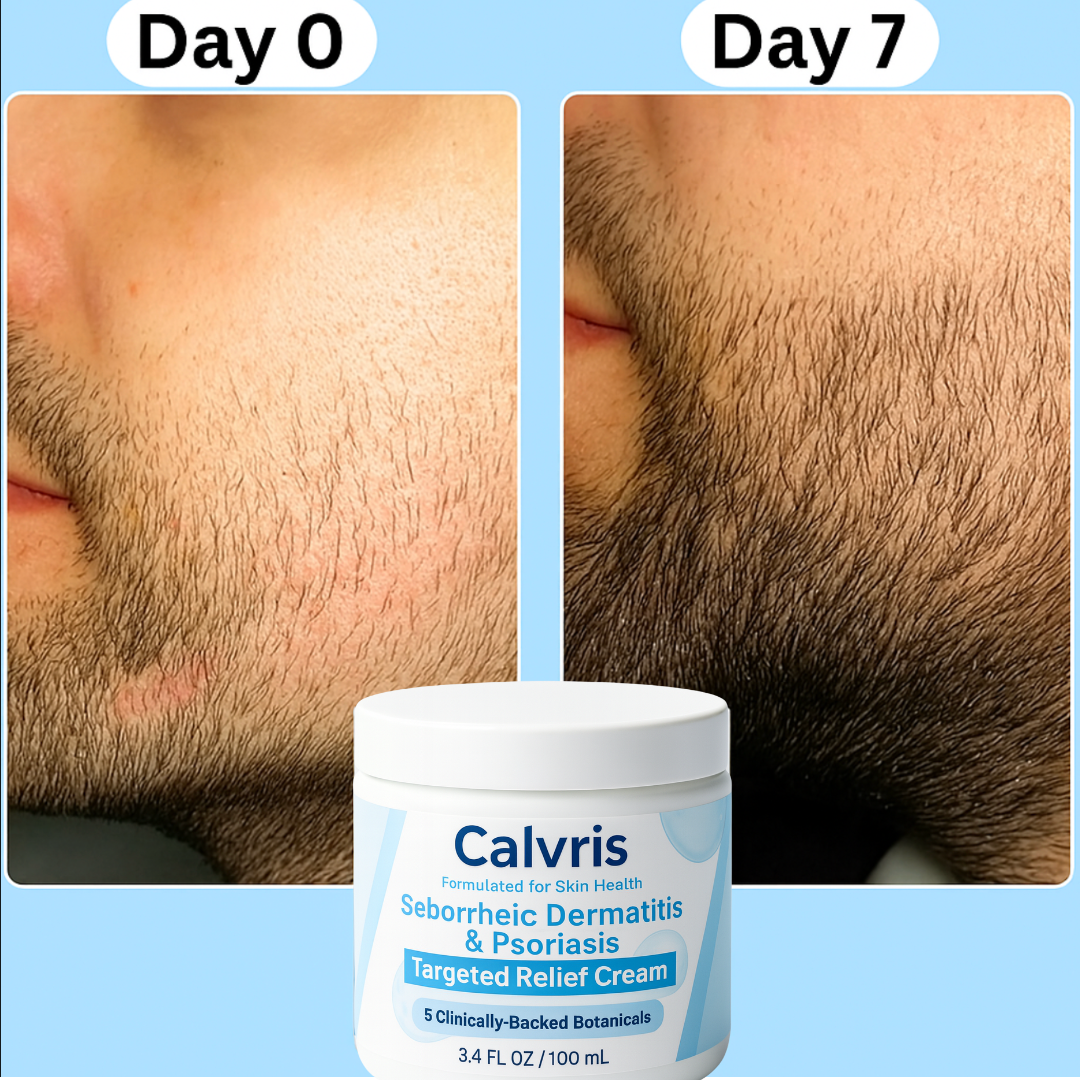 Beard Recovery Cream™