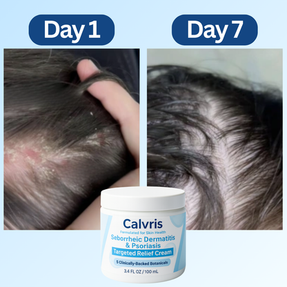 Scalp Relief Balm™
