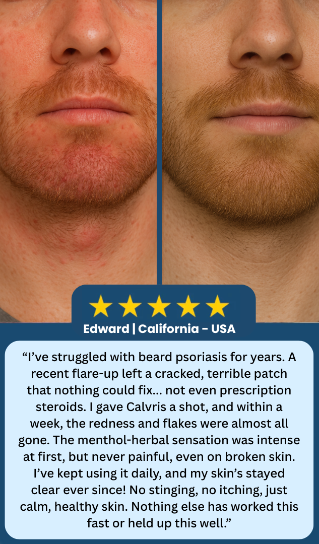 Beard Recovery Cream